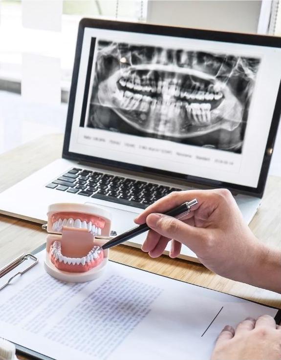 Functional Sleep Medicine Doctor pointing to a display of teeth with x-ray of mouth on laptop in backgrount. Change your life find root causes of sleep apnea with wholistic medicine.